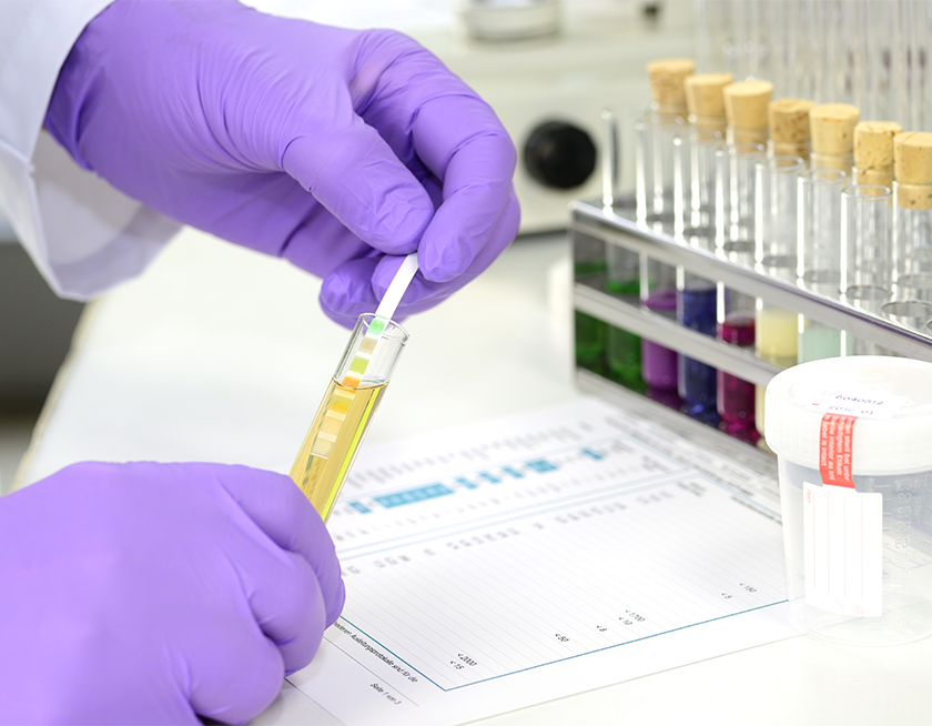 Drug Screening